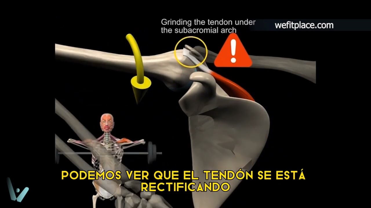 Análisis Biomecánico en un minuto - ⚠️Remo al Mentón⚠️ - wefitplace