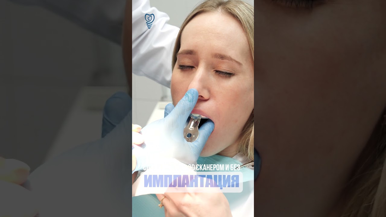 Слепки зубов с 3D сканером и без. Dental casts with and without a 3D scanner. #dentist