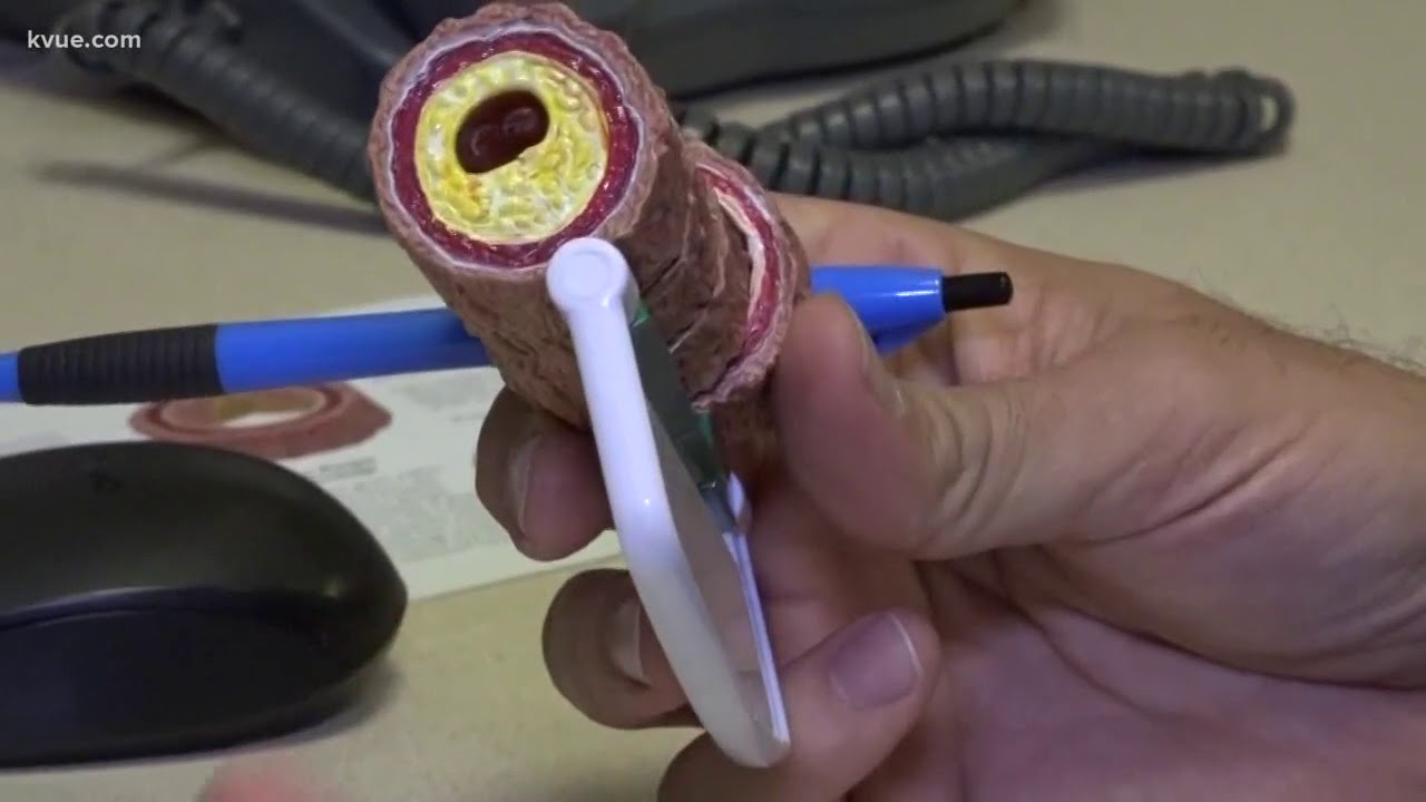 Study links heart attacks among flu patients