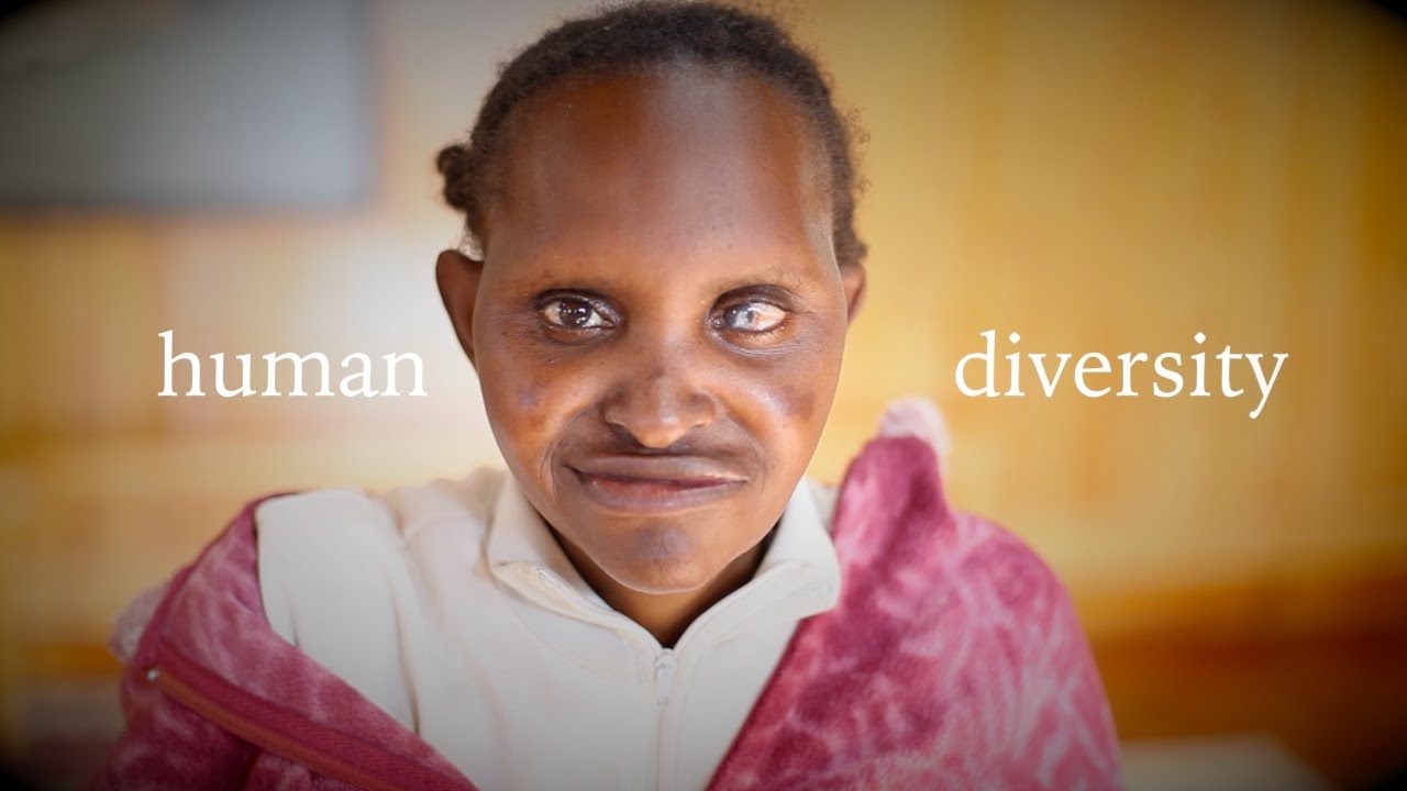 Stop Ableism-  L'Arche Kenya