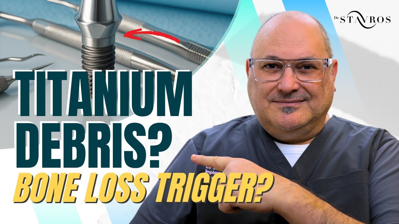 Implant Debris, Tribocorrosion, and the Biology Behind Bone Loss
