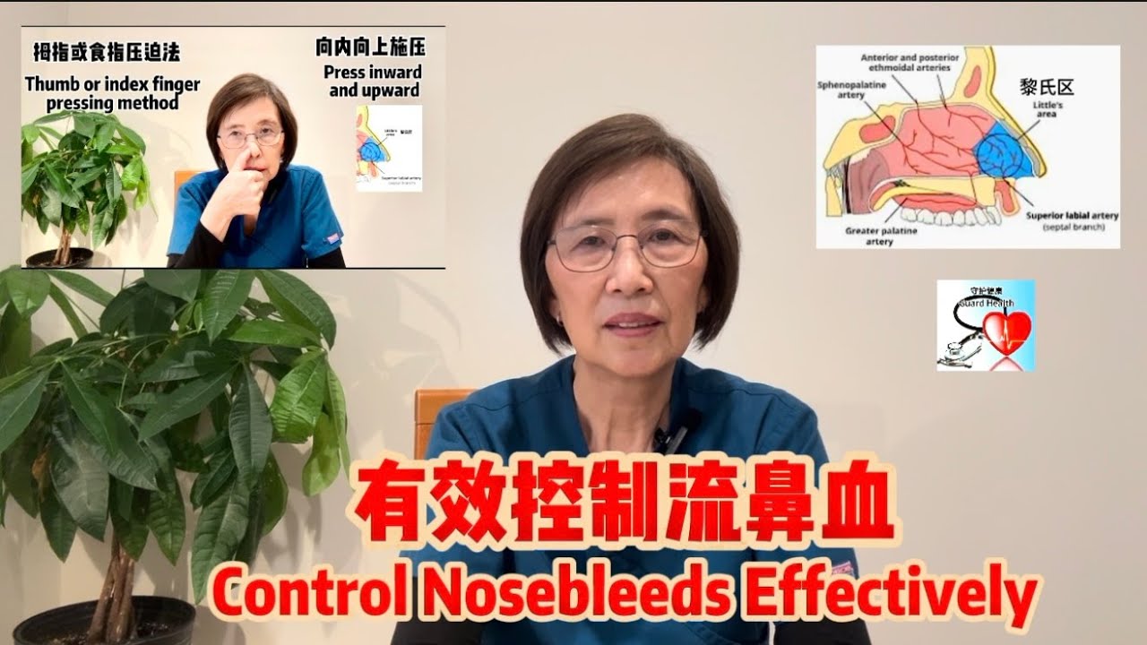有效控制流鼻血 Control Nosebleeds Effectively 医疗保健百宝箱 (24) Healthcare Treasure Box (24)