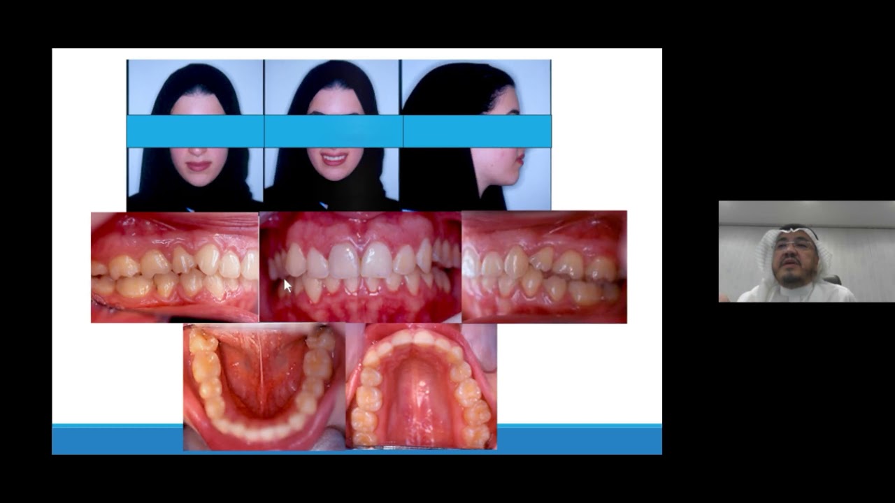 Evidence based vs clinical based orthodontics
