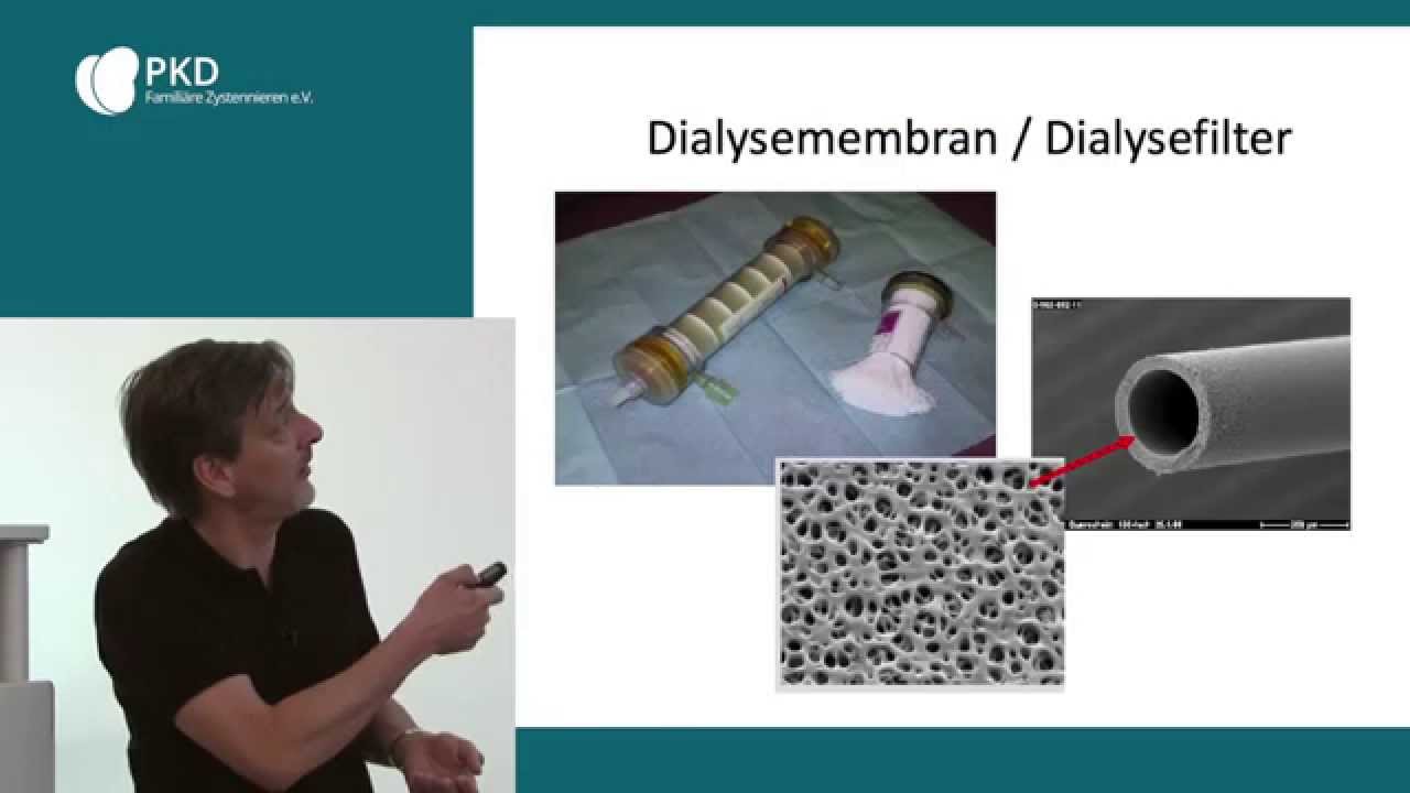 H&auml;modialyse bei Zystennieren (ADPKD)