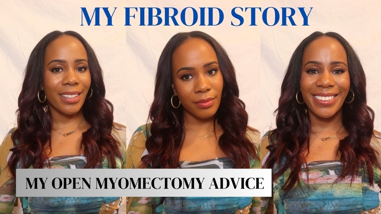 My Fibroid Story | Open Myomectomy Experience and Advice