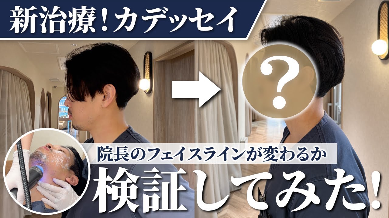 新治療！カデッセイで院長のフェイスラインが変わるか検証してみた！