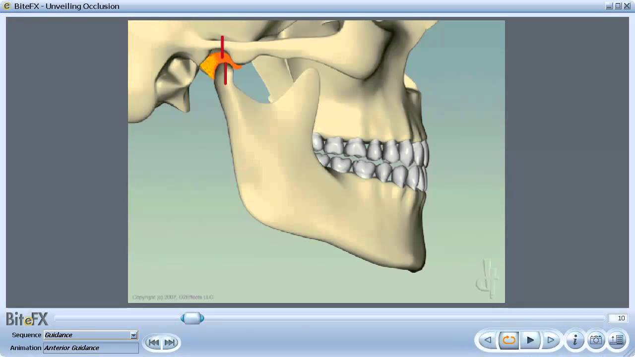Anterior Guidance