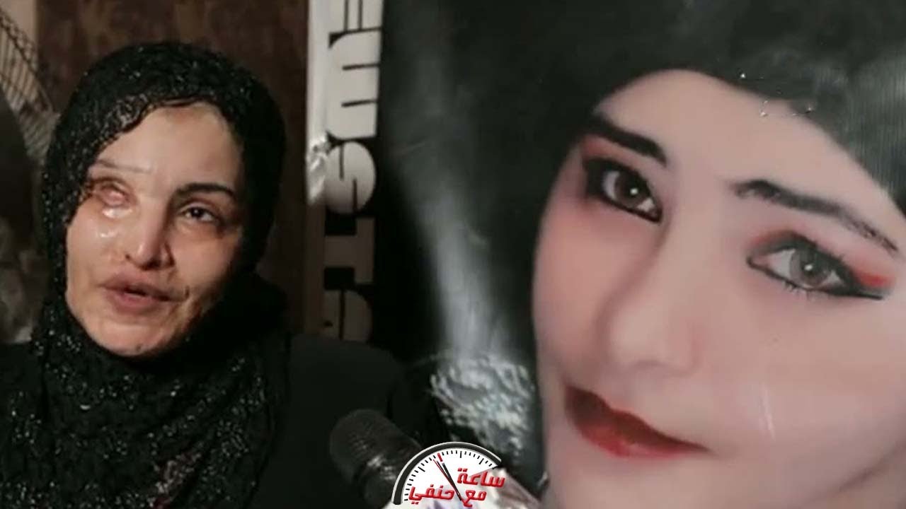 هبه رفضت الجواز من اخو جوزها فـ ـشـ ـوه وجهها بطريقه بـ ـشـ ـعـ ـه