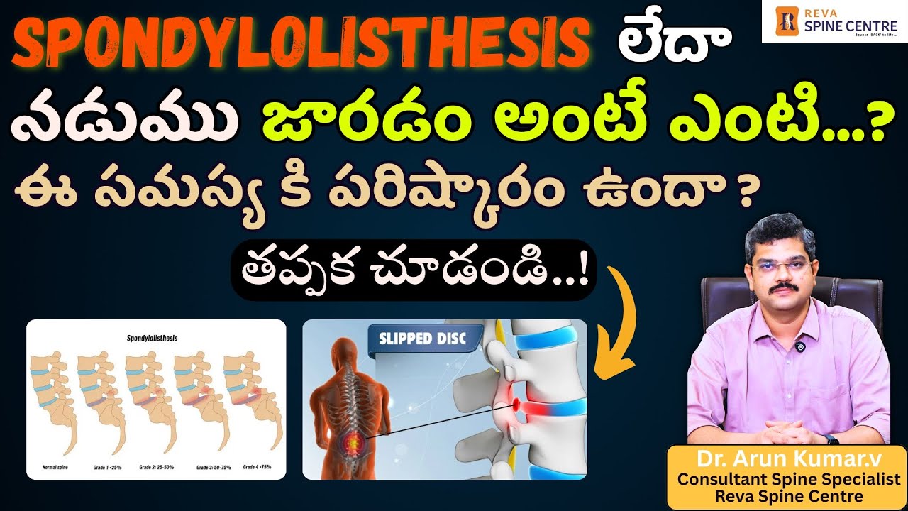 What is Spondylolisthesis? || How it can be cured? || Dr. Arun Kumar || Spine Health | Visakhapatnam