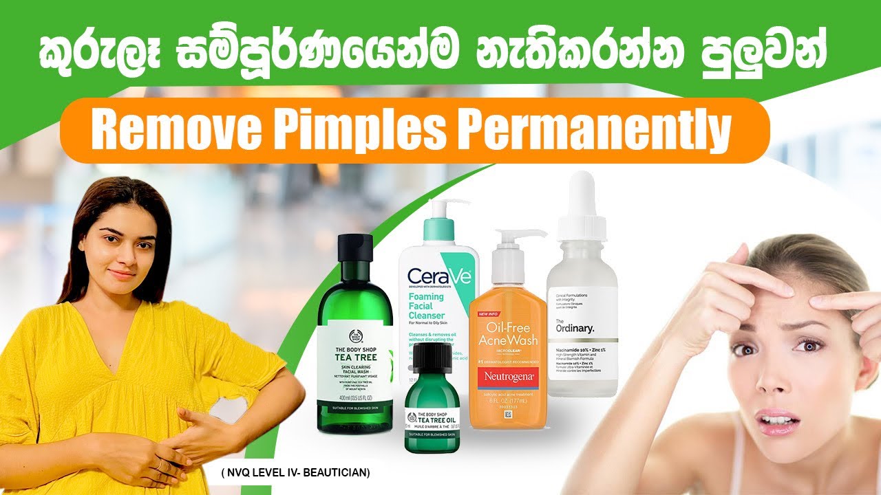 How To Remove Pimples Permanently | සම්පූර්ණයෙන්ම කුරුළෑ අඩුකරගන්න