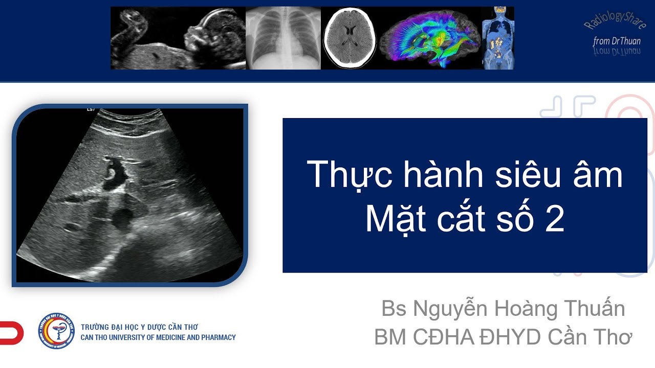 Hướng dẫn thực hành MCCB -2021- MC số 2
