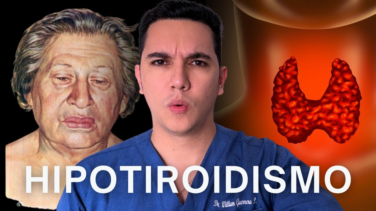 Hipotiroidismo: causas, síntomas y ￼tratamiento | Dr. William Guerrero