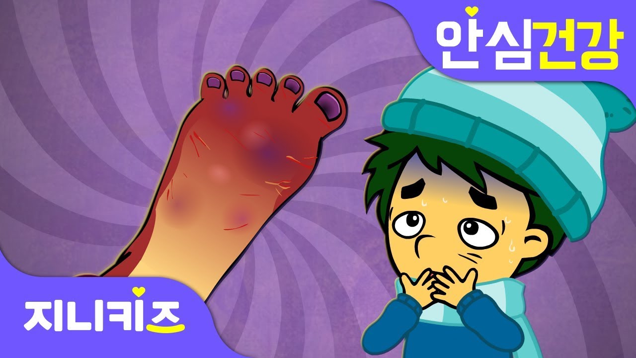 손발이 꽁꽁! 동상에 걸렸어요 | 겨울철 동상 원인 및 예방법 | 안심 건강★지니키즈