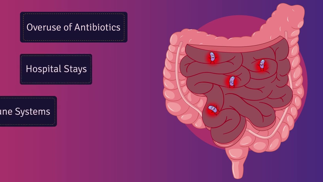 Qu'en est-il du Clostridium difficile (C. difficile)