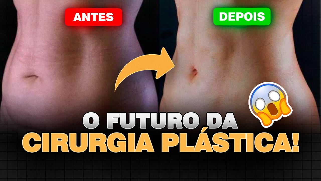 A TECNOLOGIA IGNITE VAI MUDAR SUA CIRURGIA PLÁSTICA! 🔥 | Dr  Ícaro Samuel