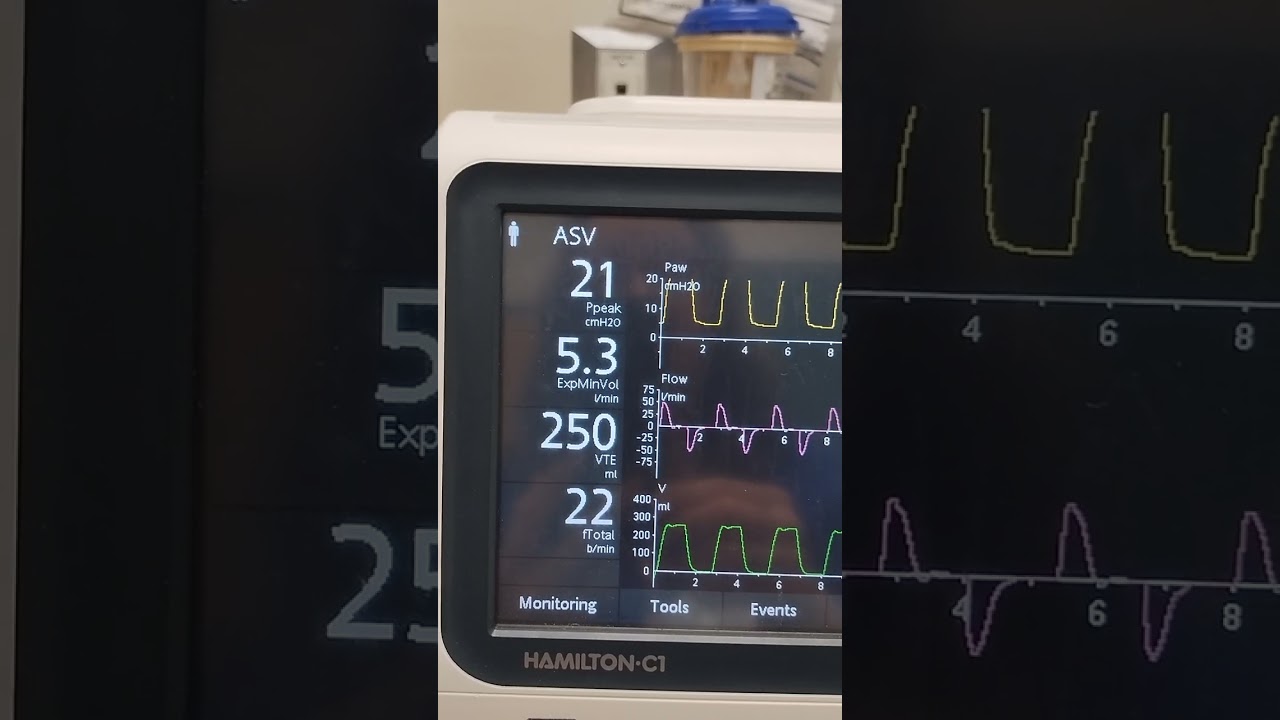 Hamilton C-1 ASV Mode