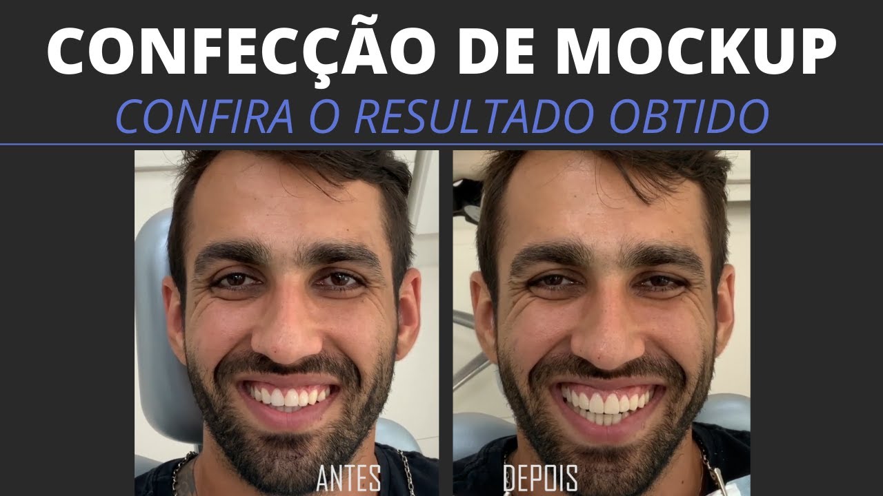 Confec&ccedil;&atilde;o de Mockup - Confira o resultado obtido!