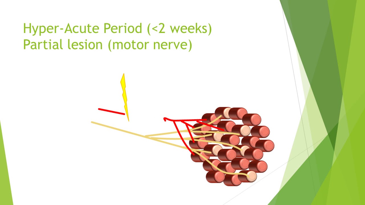 Nerve damage and repair