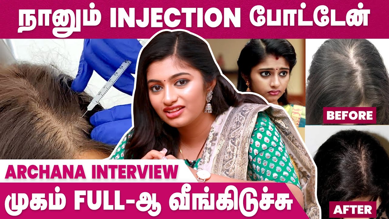 முடி வளரத்துக்கு ஊசி போட்டேன் | Raja Rani 2 Archana Interview | VJ Archana Hair Care | IBC Mangai