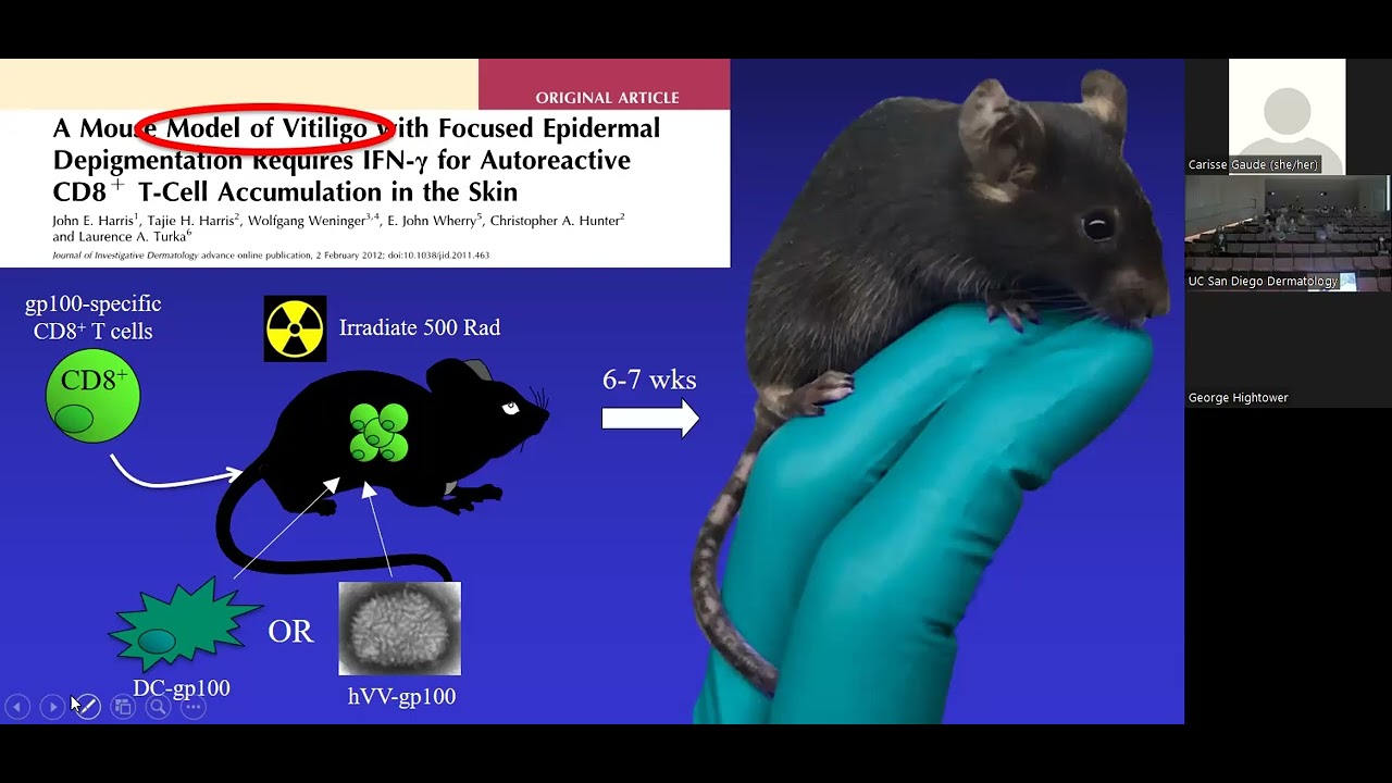 Translational research in vitiligo Launching a new era of targeted treatments -  John E  Harris, MD,