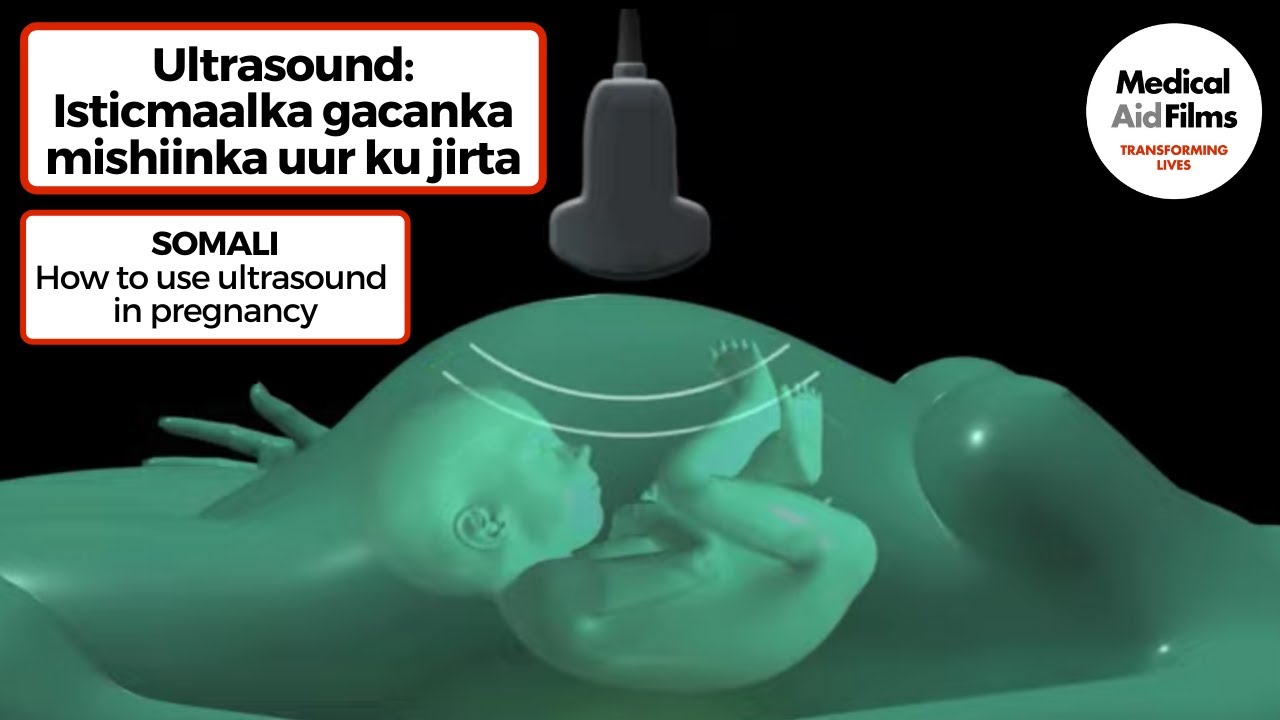 Ultrasound – Isticmaalka gacanka mishiinka uur ku jirta