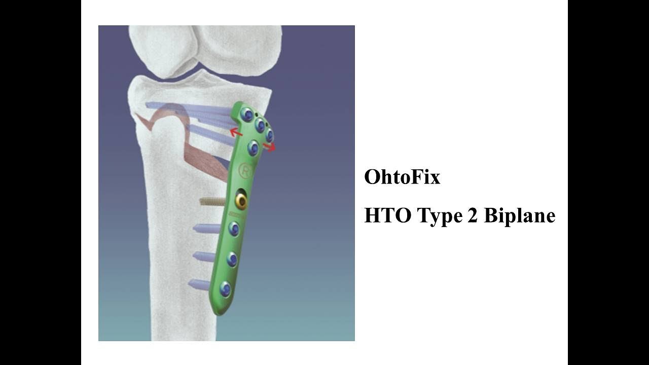 Ohtofix HTO Type 2 - Biplane (sawbone실험)