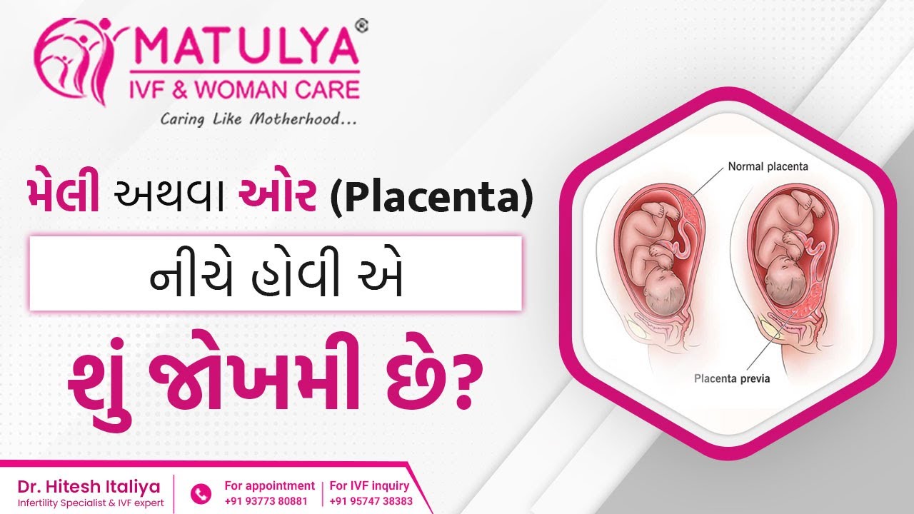 મેલી અથવા ઓર (placenta) નીચે હોવી એ શું જોખમી છે ? |Matulya IVF & Woman care|Dr.Hitesh italiya|Surat