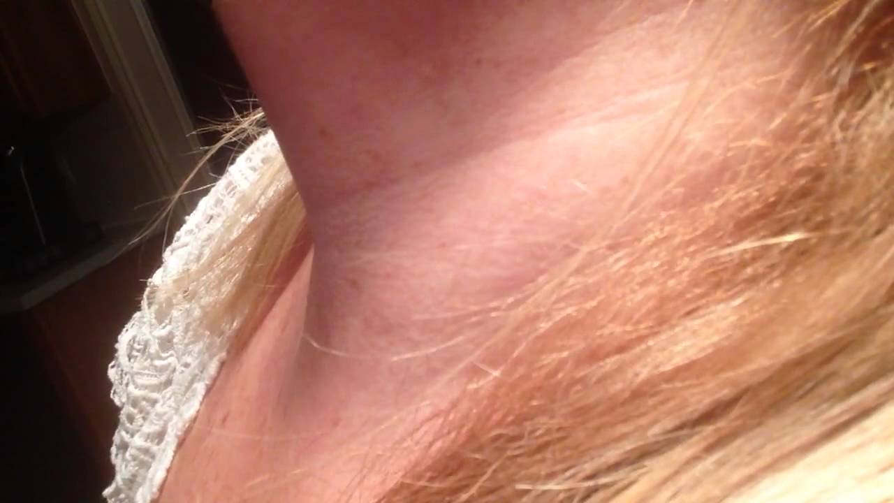 Adam's apple old woman 3