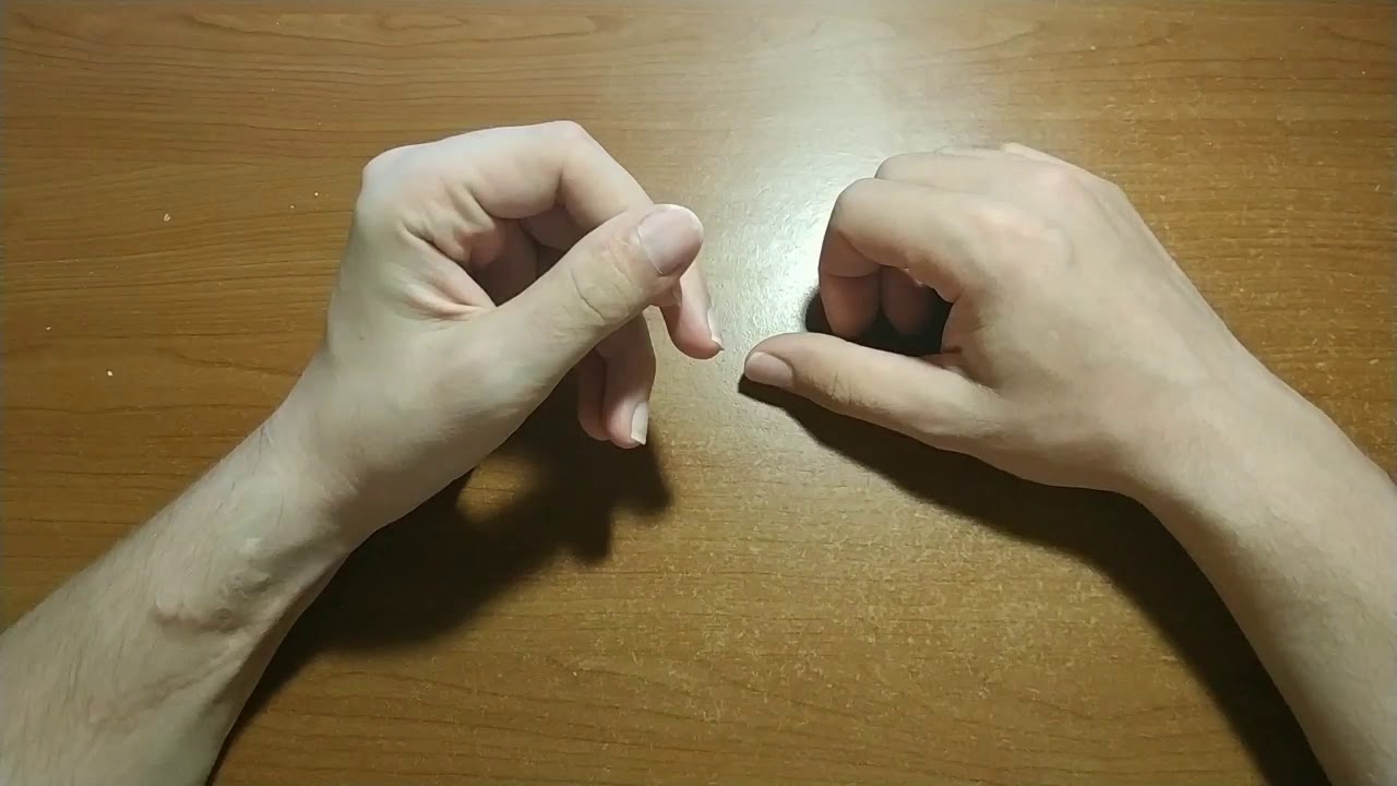 Рука, нерв, локтевой, лучевой, травма.