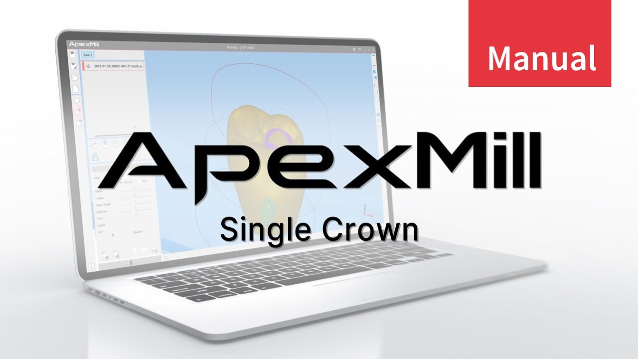ApexMill_Single Crown (ENG)