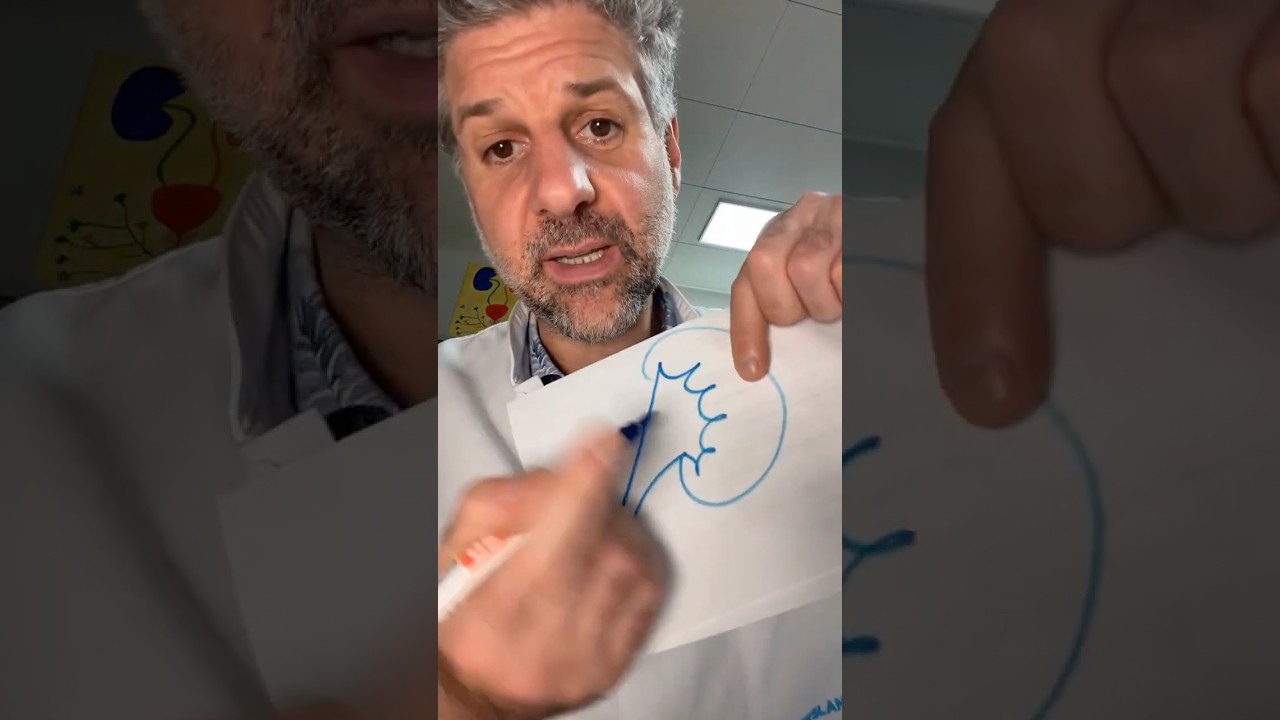 LIVE Sprechstunde: Nierenstein im Unterpol &ndash; geringe Chance auf spontanen Abgang | Dr. Randazzo