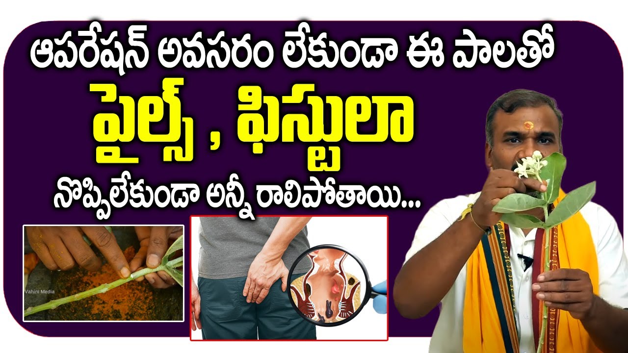 ఈ చెట్టు పాలలో ఇది నూరి రాస్తే పైల్స్ నొప్పి లేకుండా రాలిపోతాయి || Cure piles naturally at home
