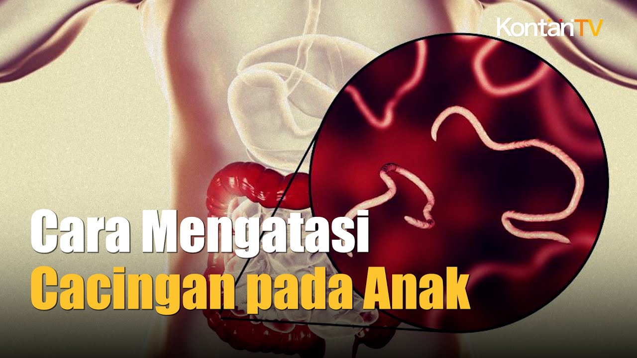 Cara Mengatasi Cacingan pada Anak