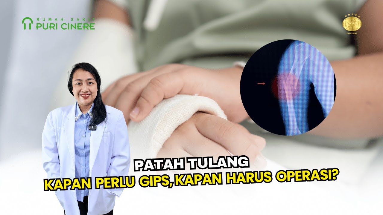 Patah Tulang Harus Gips atau Operasi? Penjelasan Dokter Spesialis Bedah Orthopedi dan Traumatologi