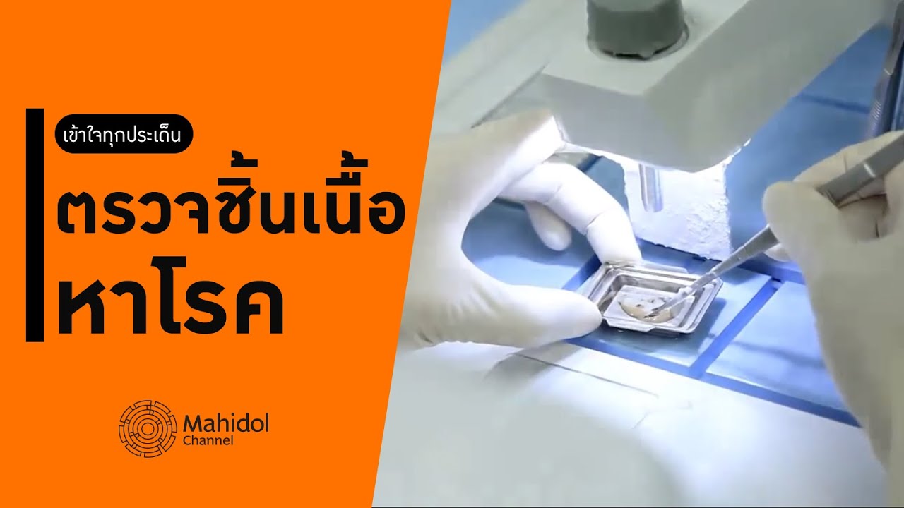 เบื้องหลังการตรวจชิ้นเนื้อ เจาะลึกขั้นตอนสำคัญของการวินิจฉัยโรค [หาหมอ by Mahidol Channel]