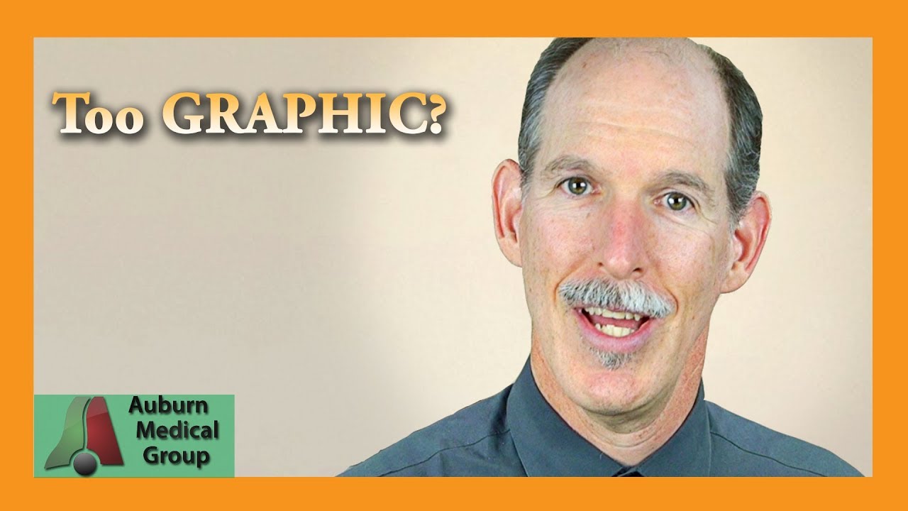 Too Graphic for YouTube? | Auburn Medical Group