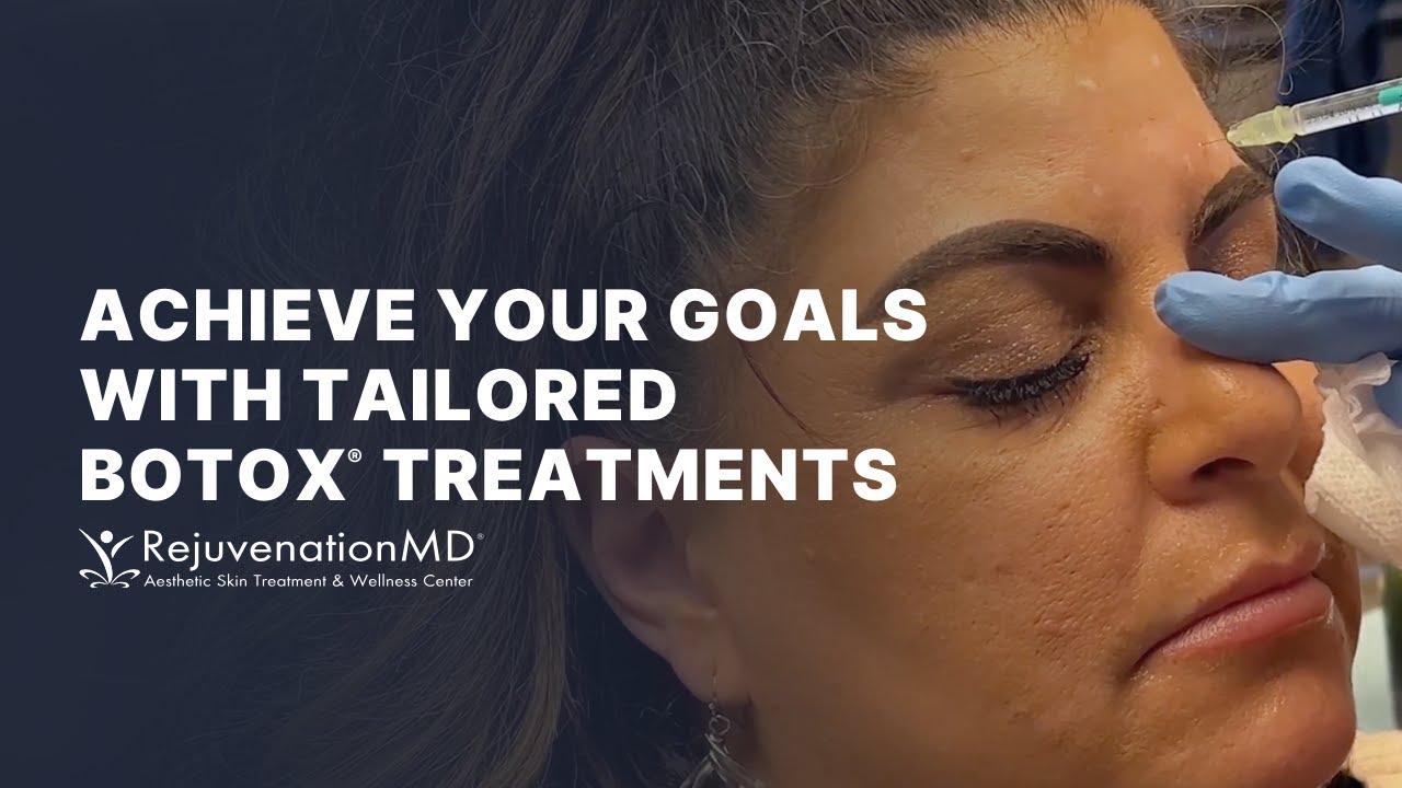 Botox for 11s and Forehead
