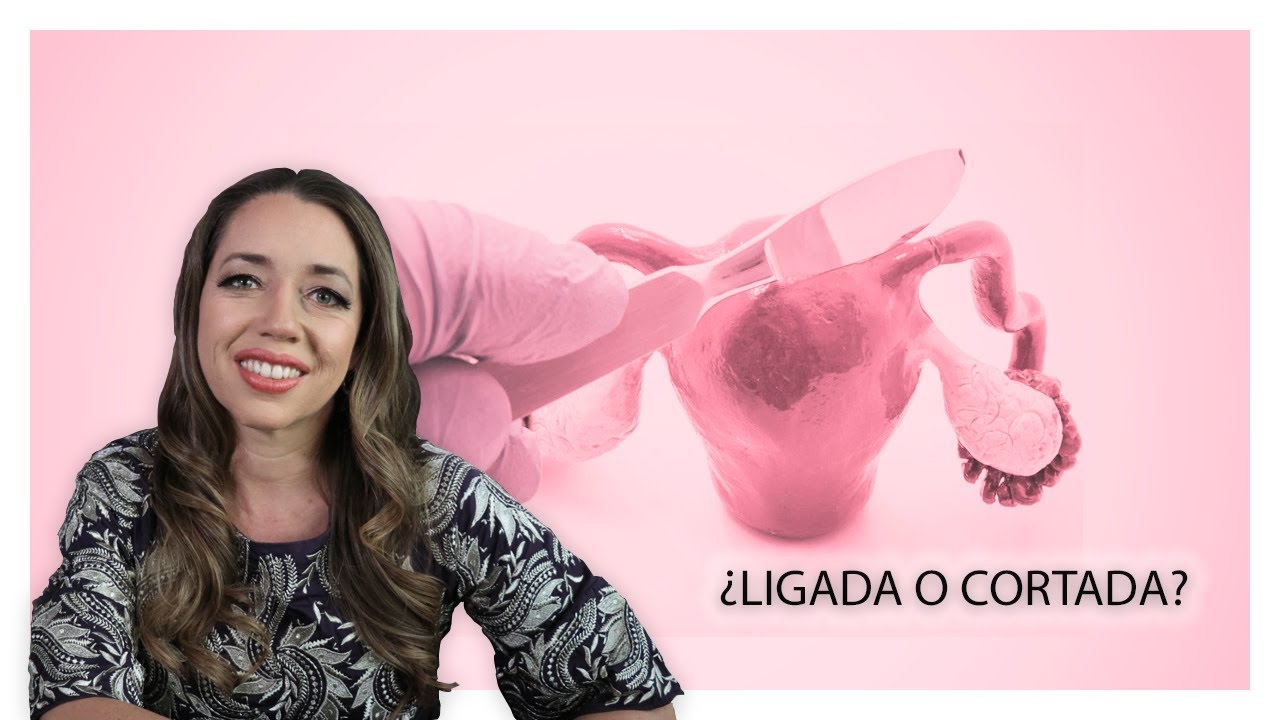 ¿Ligada o cortada? ¡Conoce todo lo que debes saber sobre la “Salpingo”!