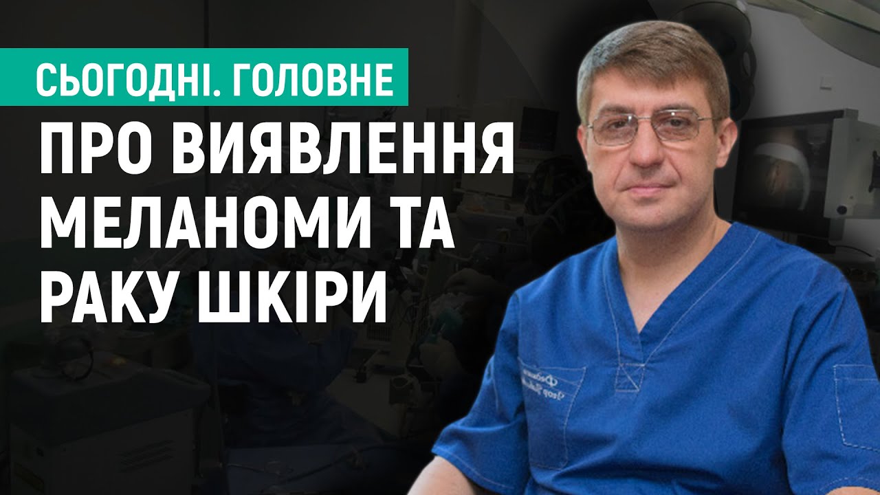 На Вінниччині меланому та рак шкіри виявляють на останніх стадіях захворювання  І  Сьогодні.Головне
