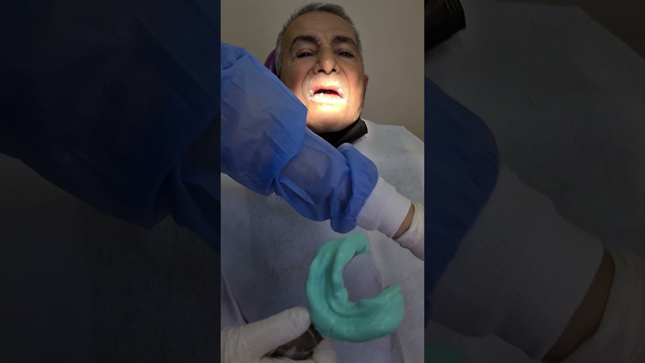 1  Total Protez İçin Hastadan Anatomik Ölçü Alınması ve Ölçünün Dökülmesi