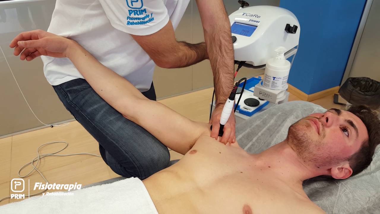 Diatermia T-Care - Tendinosis de hombro