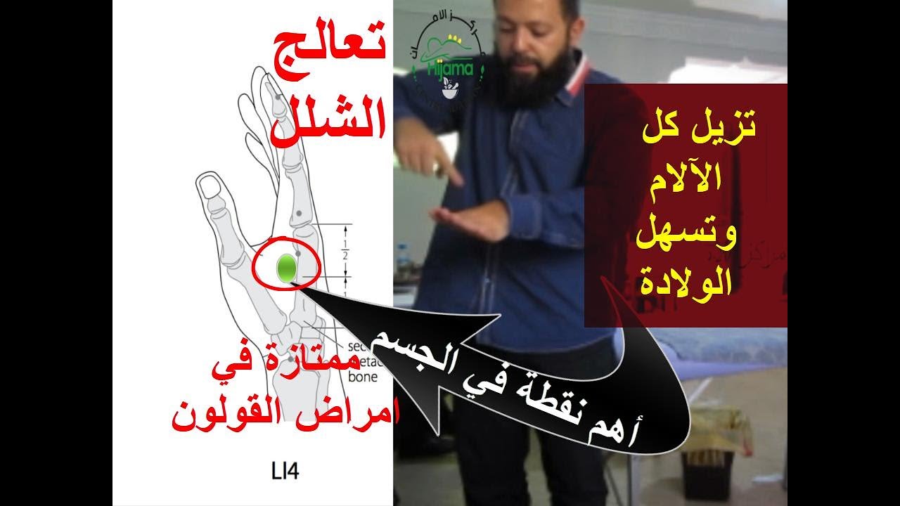 صيدلية من المسكنات جعلها الله فيك: نقطة إعجازية لعلاج آلام  جسمك