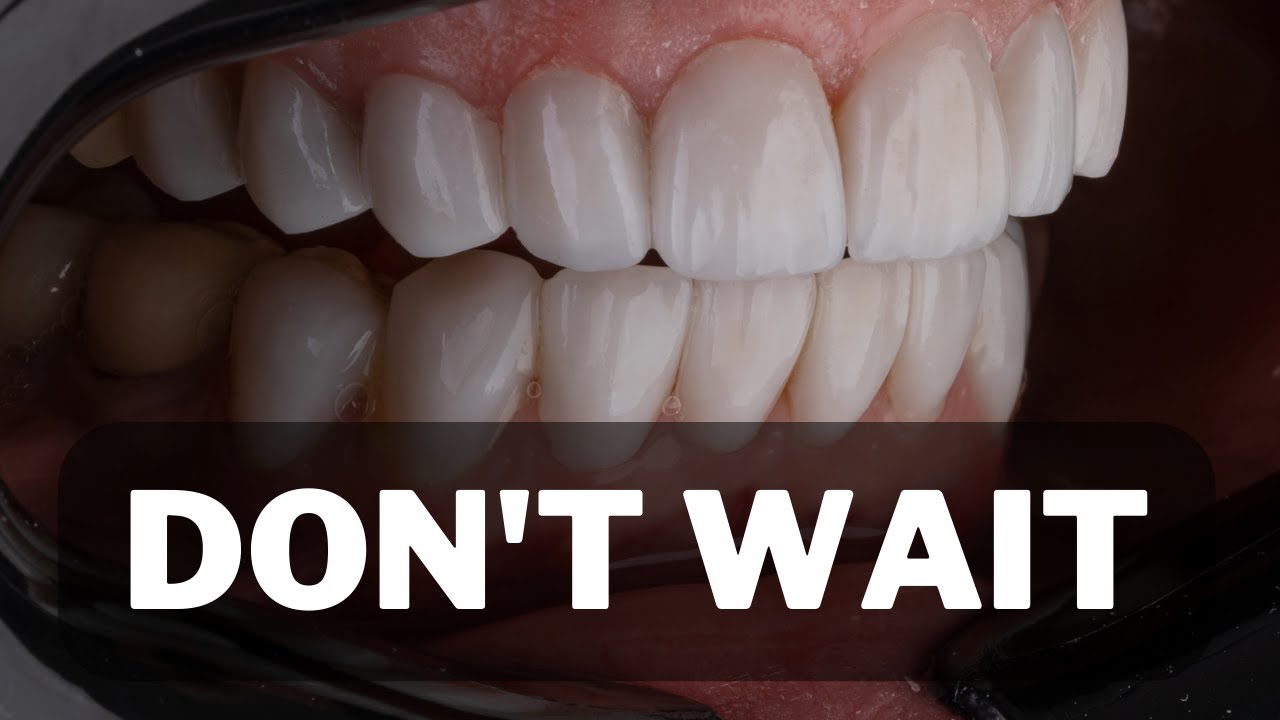 JS Dental Lab Night Guard Review