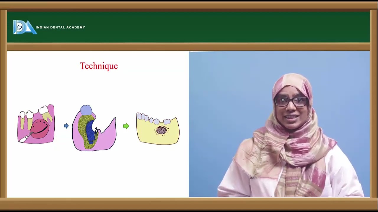 Cyst treatment plan part 2 | Oral and Maxillo facial surgery | #NEET#MDS#BDS#NBDE#ORE#DDS