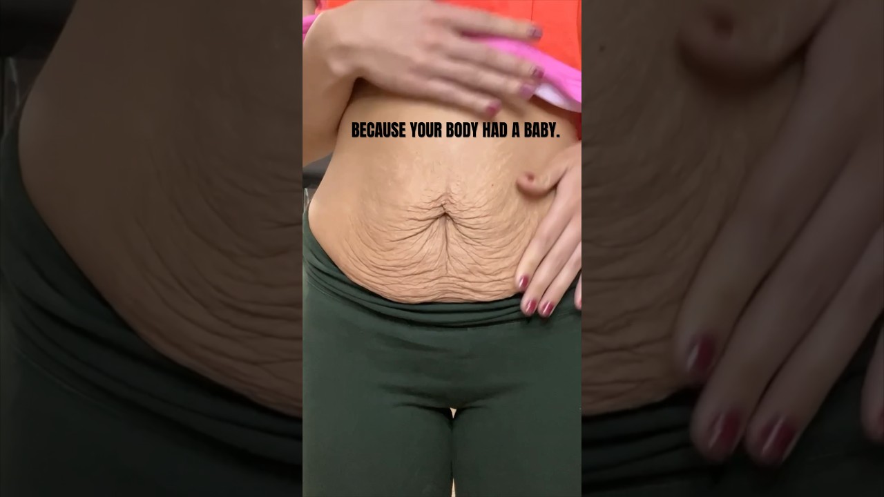 The truth about postpartum bodies ✨ #mom #pregnancy #postpartum #postpartumbody #bodyimage