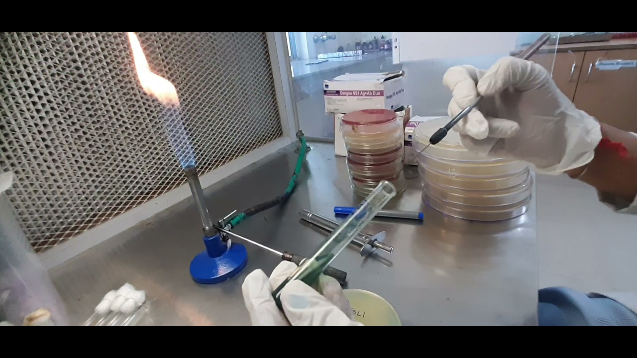 Citrate Utilization Test Method |Microbiology | #biochemical #citrate
