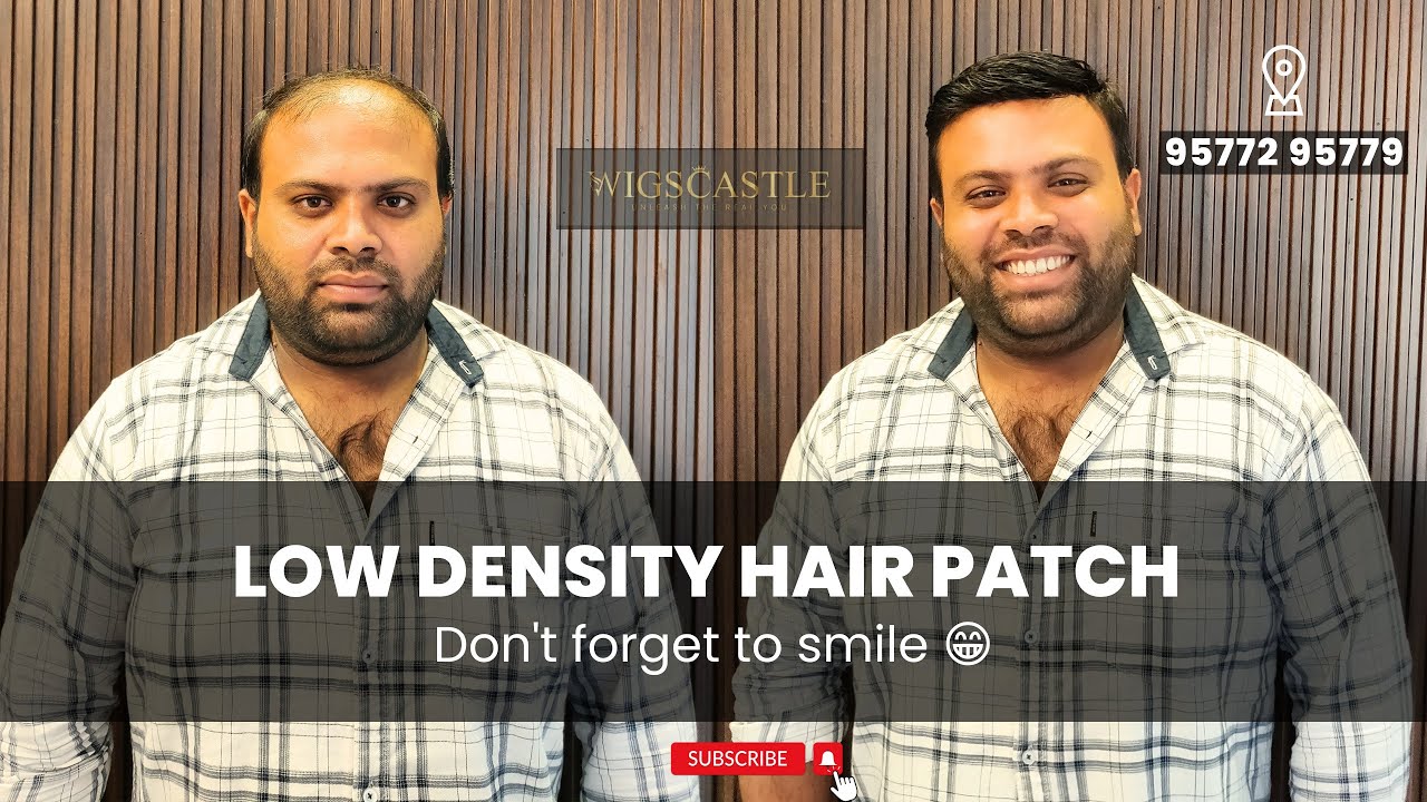Low Density Hair Patch For Men | Natural Looking Hair Patch | Stylish Patch 95772 95779, 97398 89849