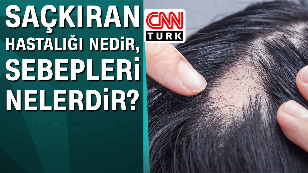 Saçkıran hastalığı nedir, sebepleri nelerdir?