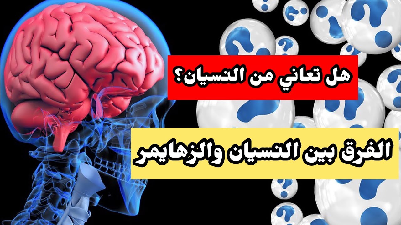 هل انت كثير #النسيان #ضروري تشاهد#الفيديو