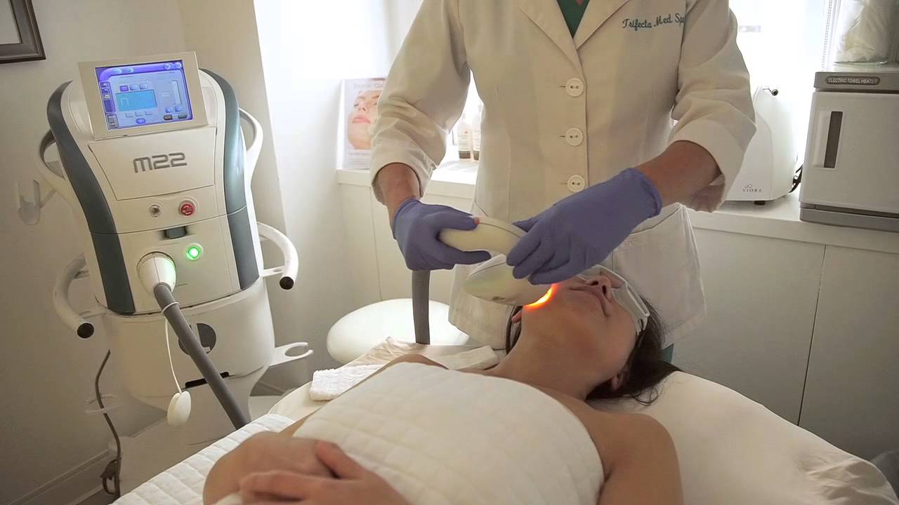 IPL Photofacial with Lumenis M22 at Trifecta Med Spa